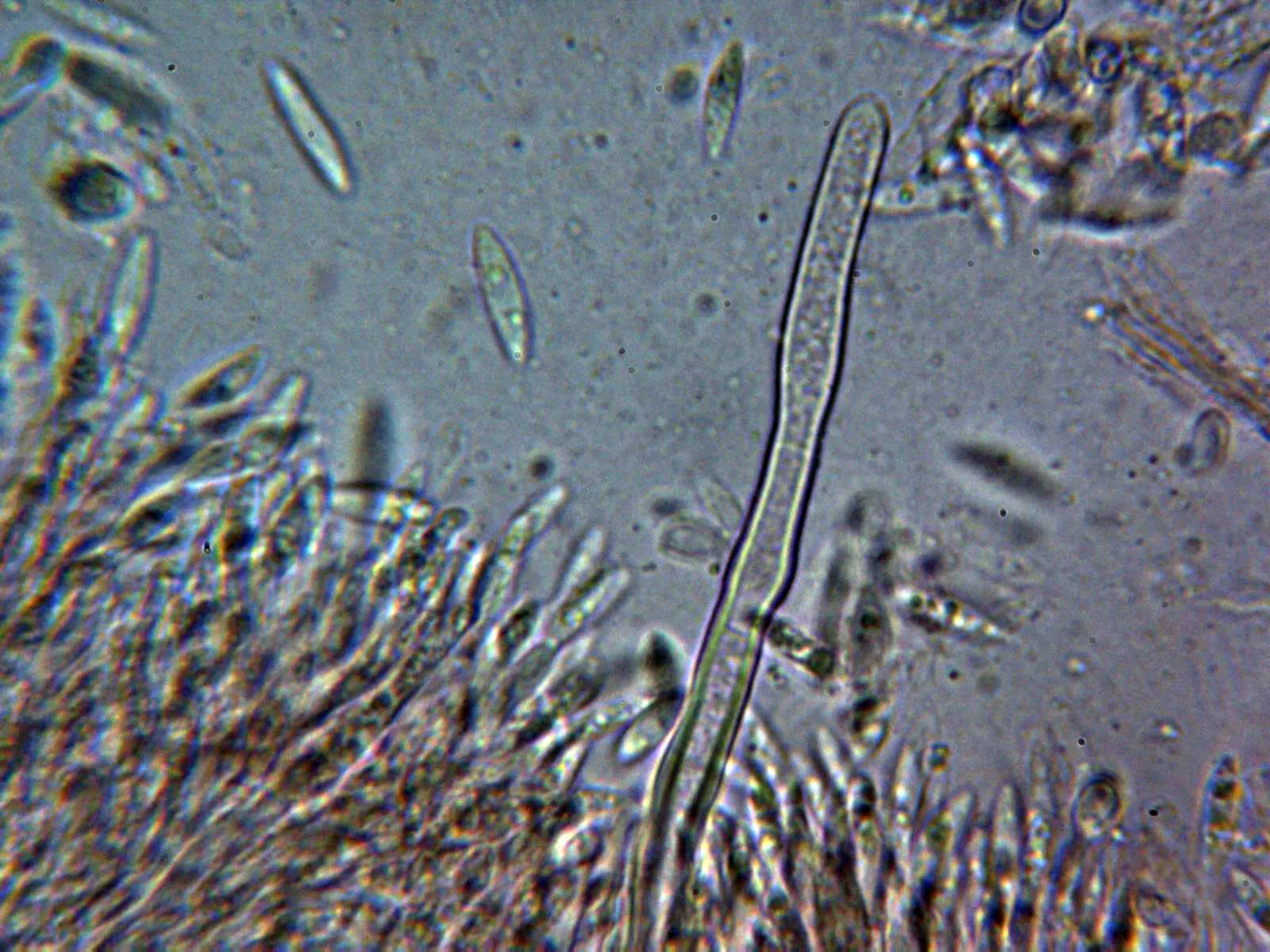 Microscopía de Pseudonectria buxi - 10 - Conidióforos esporodoquiales